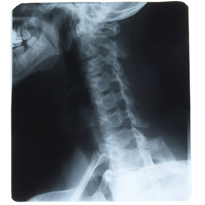 Full Speed X-Ray Film - Green - Box of 100