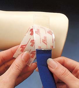 Alpha Splintstraps by North Coast Medical - Package