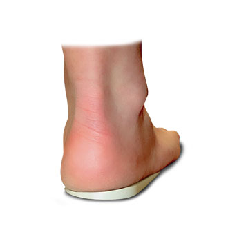 Heel Wedge by Core Products