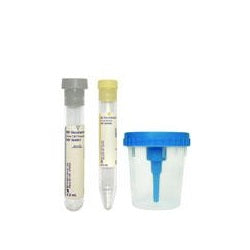 Becton Dickinson Vacutainer Urine Collection Kit with Screw-Cap Cups ...