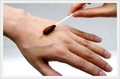 Povidone Iodine 10% USP Swabstick - Singles