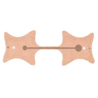 IontoPatch Iontophoresis Treatment Kit 12.0 cm by Fabrication Enterprises - FAB236