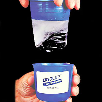 Cryocup Ice Massage Therapy by Cryo Therapy Inc - Singles