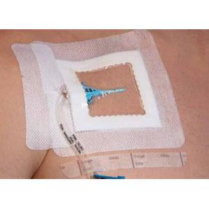 Integrated Securement Dressing Sorbaview SHIELD Fabric By Medline