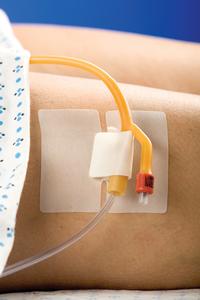 Cath-Secure Multi Purpose Tube Holder, Large Lumen, Adhesive by M.C. Johnson - Each